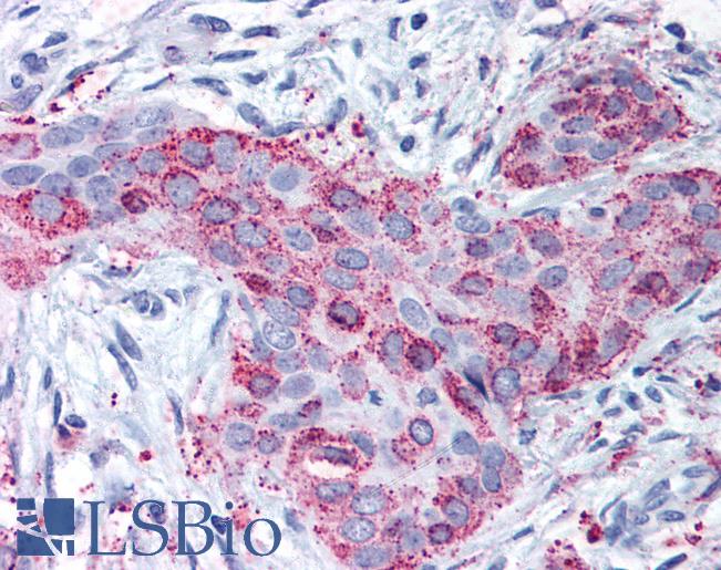 Antibodies