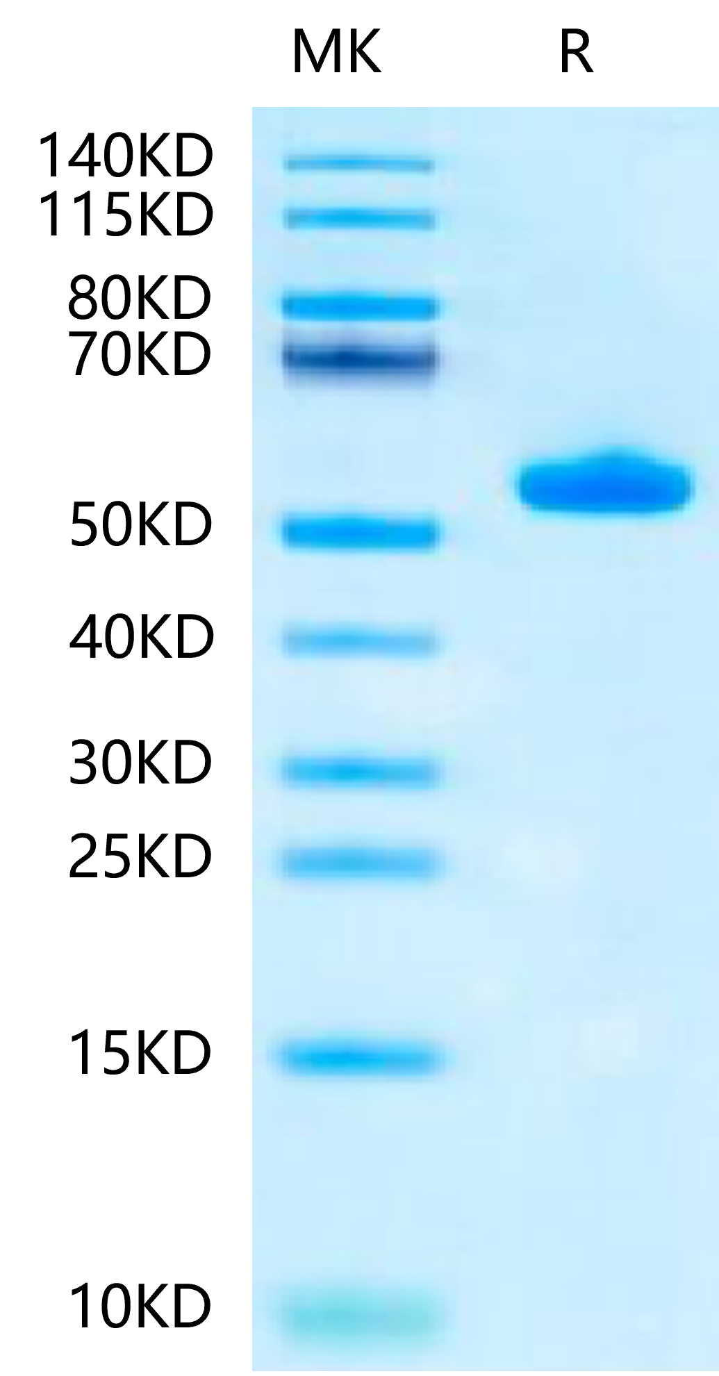 Biotinylated Human Peptide Ready HLA-A*02:01&B2M Monomer-Protein (MHC-HM43RB)