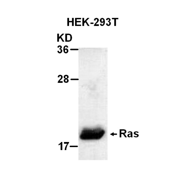 Antibodies