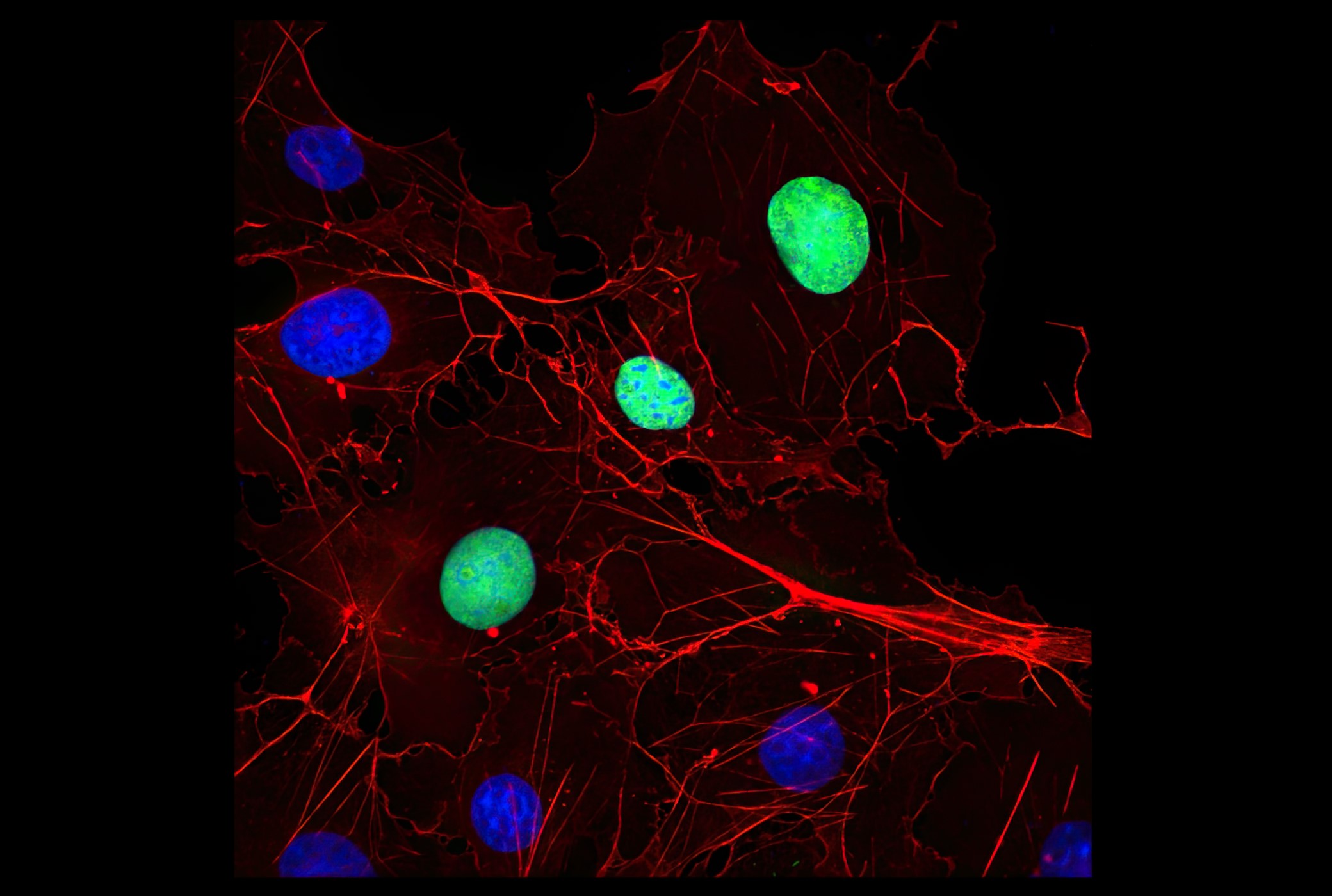 Myc-Tag (9B11) Mouse mAb #2276