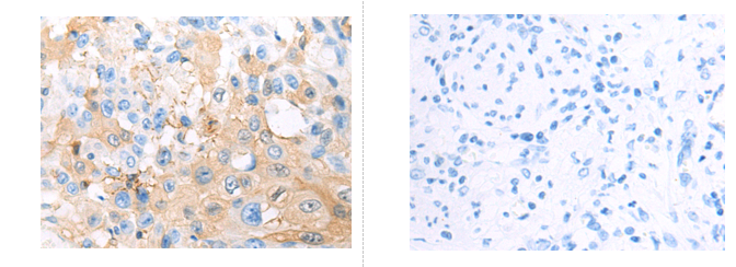 ADAMTS5 Antibody