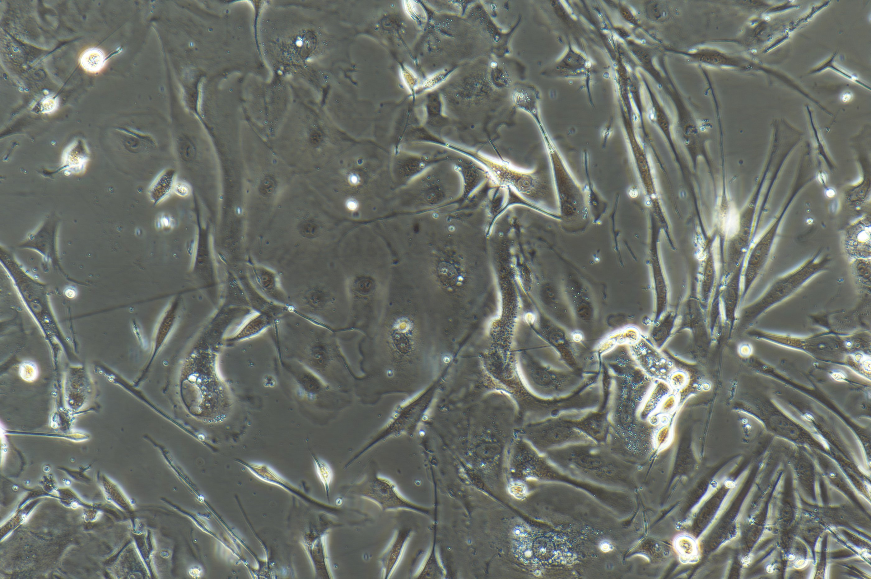 Human Primary Endometrial Epithelial Cells HEnEpiC