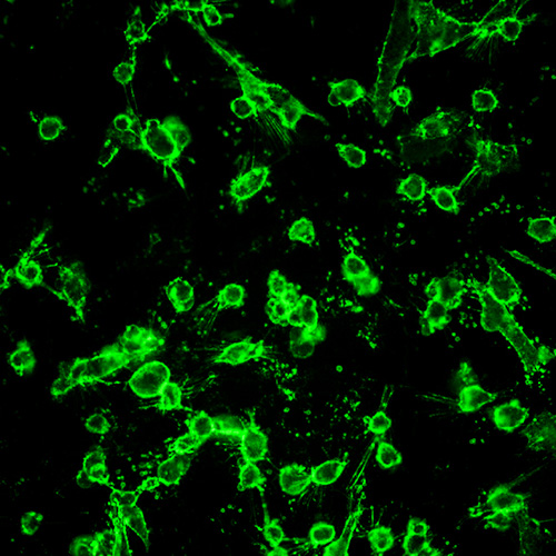 Immortalized Human Hair Dermal Papilla Cells