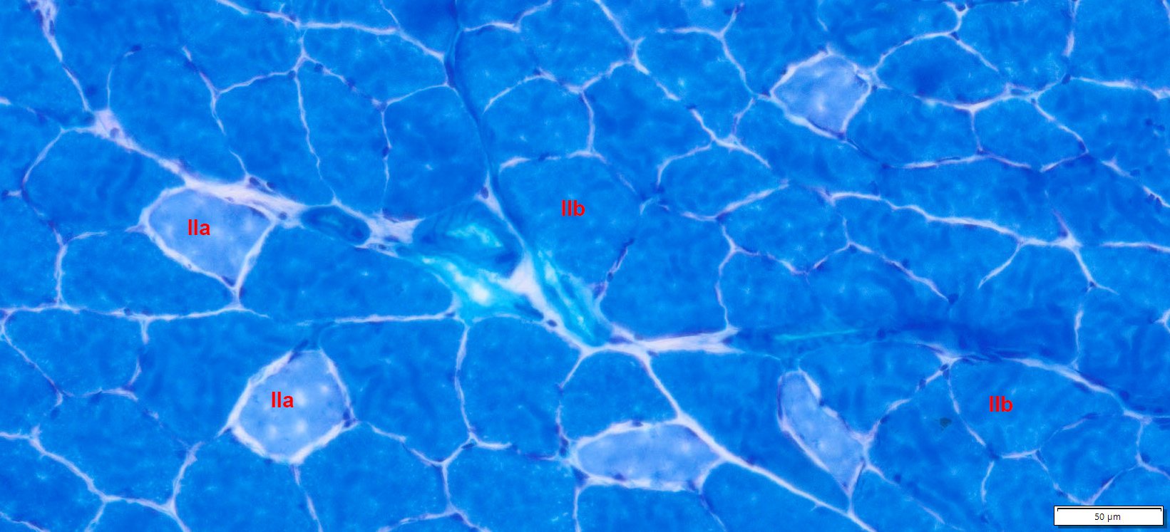 VitroView™ Metachromatic Myofibrillar ATPase Stain Kit