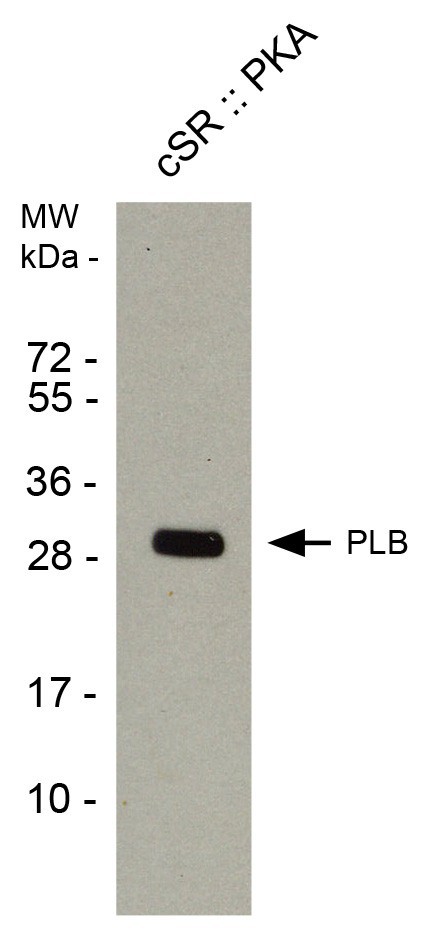 PHOSPHOLAMBAN (PLN, PLB) (pSER16) pAB IgG