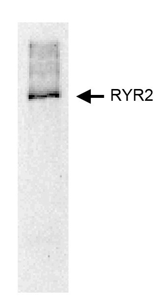 Ryanodine receptor 2 (RYR2) (pSer2808) pAb serum