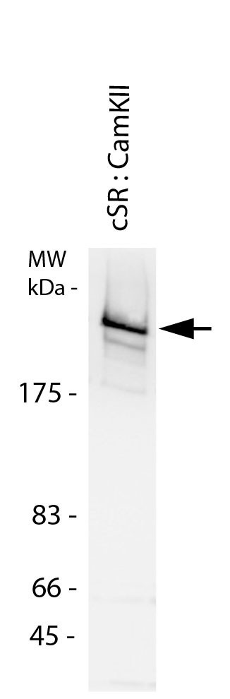 RYANODINE RECEPTOR 2 (RYR2) (pSER2814) pAB SERUM