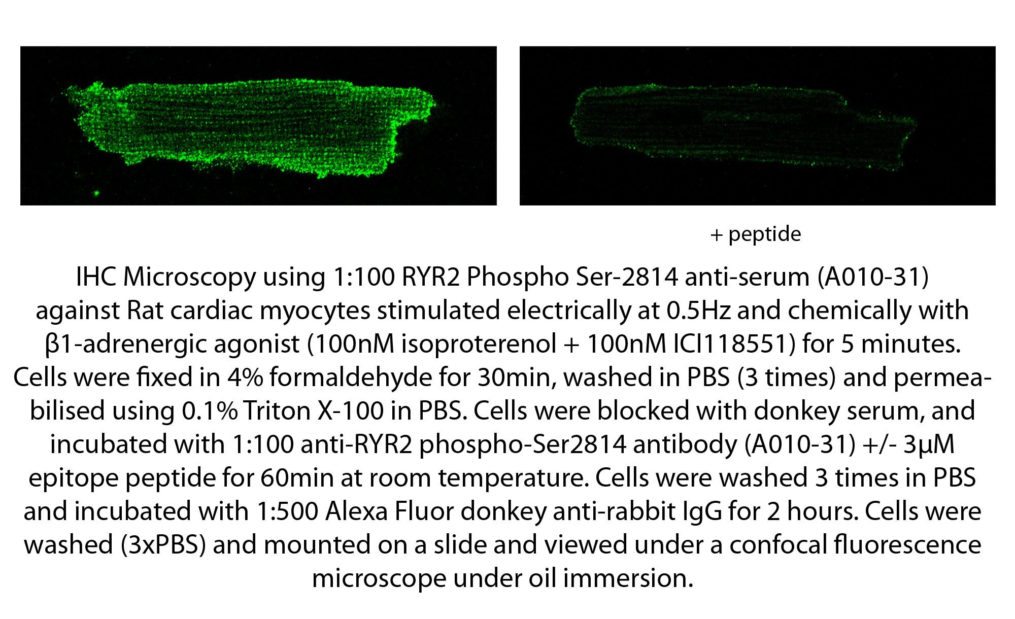 RYANODINE RECEPTOR 2 (RYR2) (pSER2814) pAB SERUM